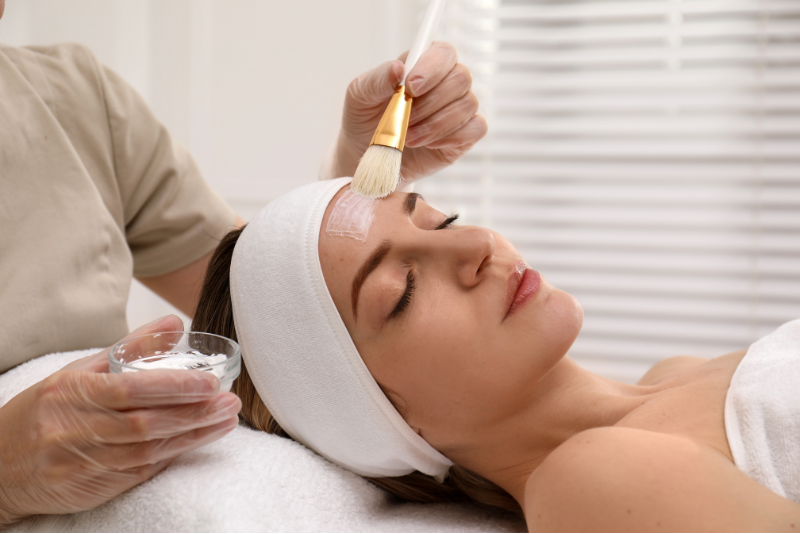 Chemical Peels Treatment
