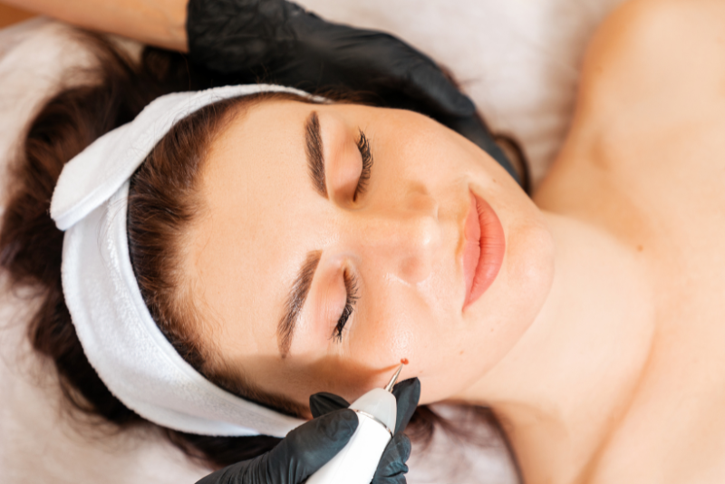 Cryotherapy & Electrocautery Treatment