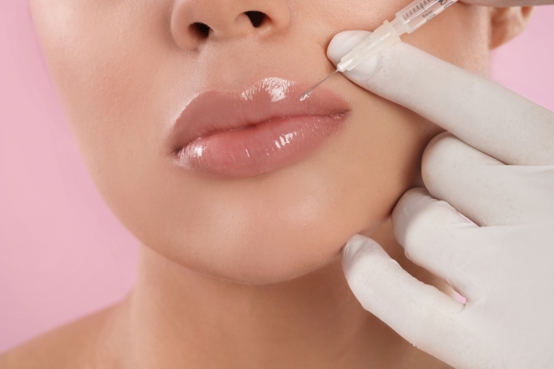 Dermal Fillers Treatment