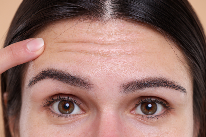 Fine Lines & Wrinkles