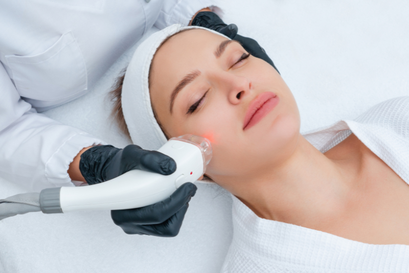 Laser for Pigmentation Treatment