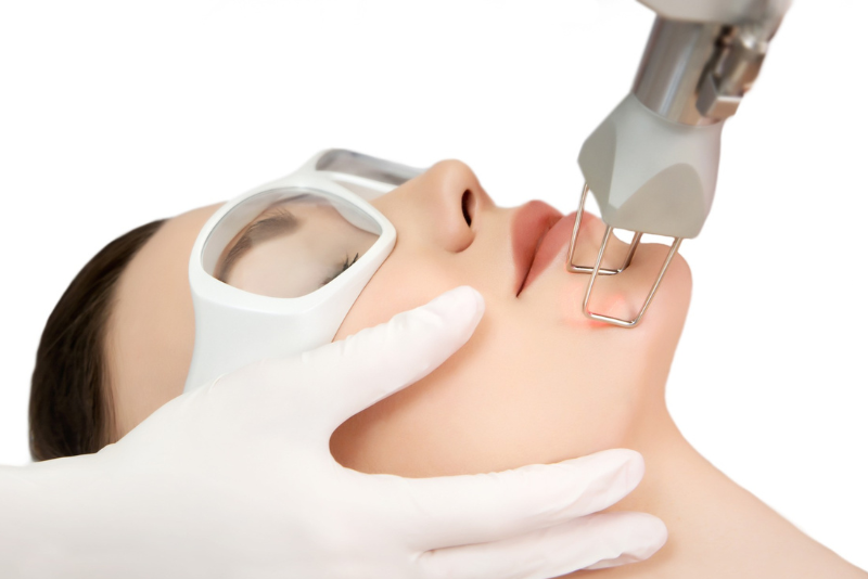 Laser Toning Treatment