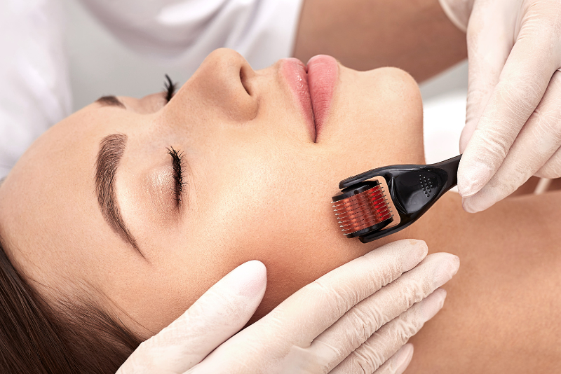Microneedling Treatment