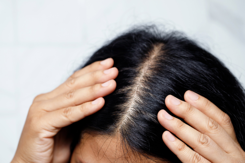 Oily & Itchy Scalp