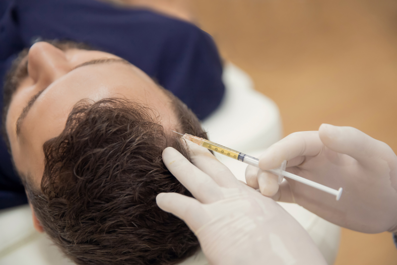 PRP Therapy for Hair Treatment