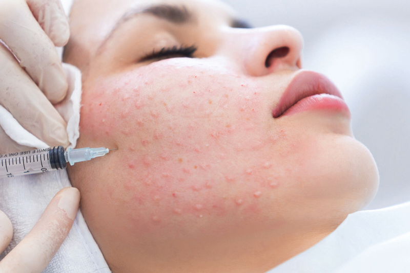 Skin Boosters & Glow Injections
