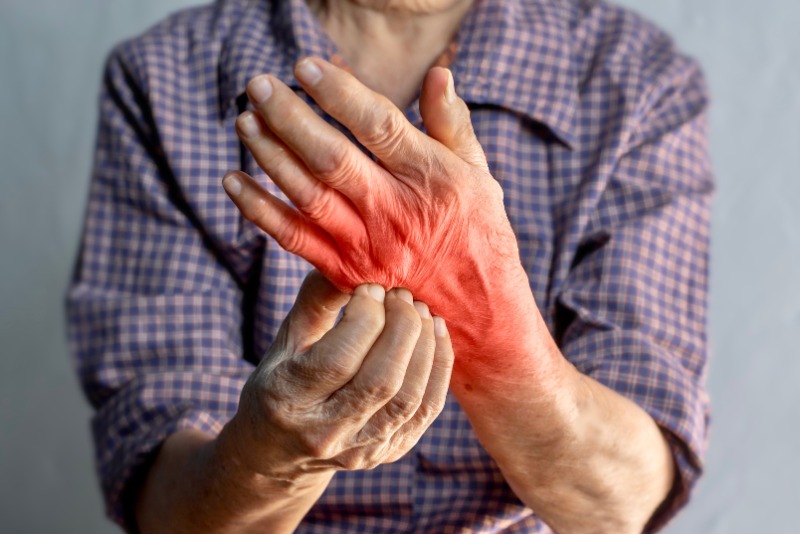 Skin Infections