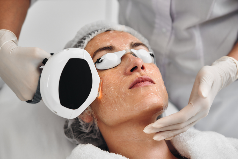 Skin Rejuvenation Treatment
