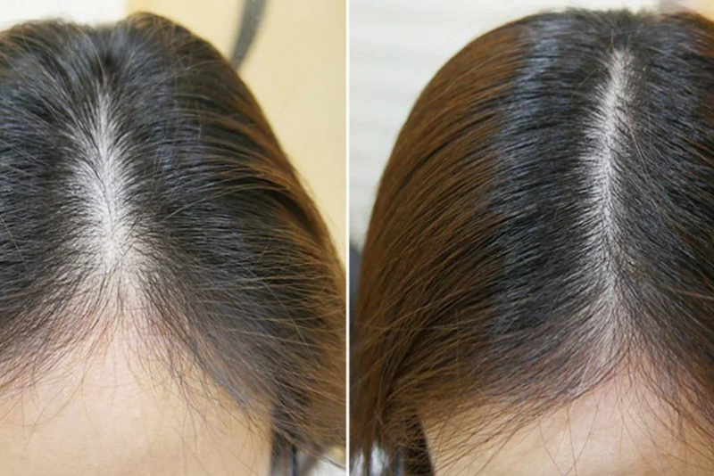 GFC Therapy for Hair